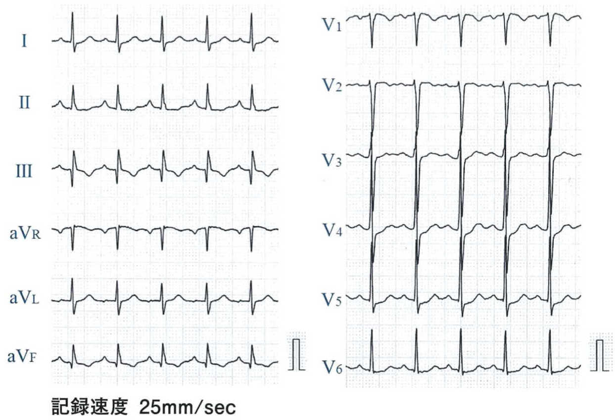 113c57 Medu4でゼロから丁寧に医学を学ぶ