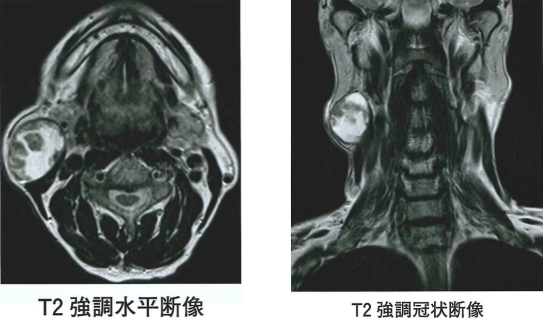 114D61 | medu4でゼロから丁寧に医学を学ぶ