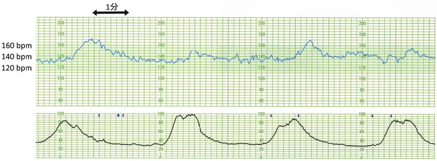 116F46 | medu4でゼロから丁寧に医学を学ぶ