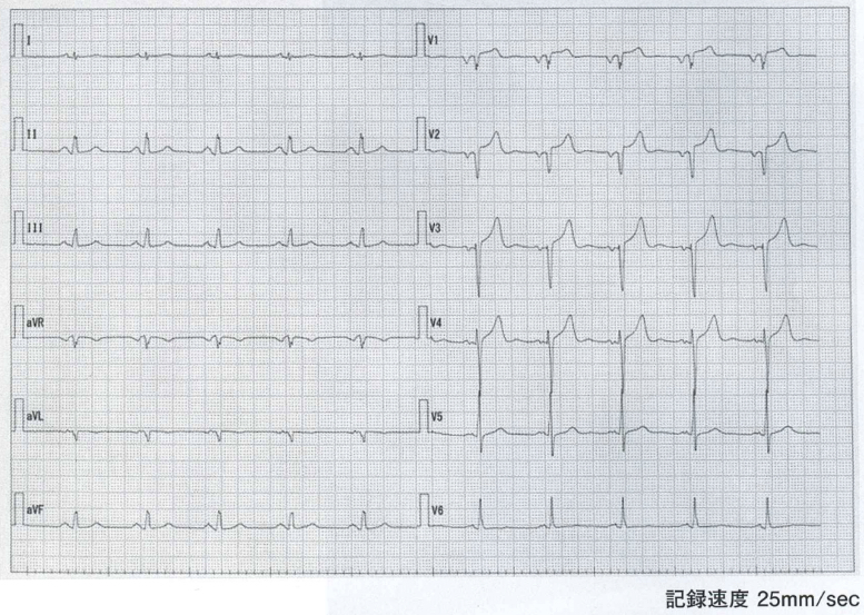 118D69 | medu4でゼロから丁寧に医学を学ぶ